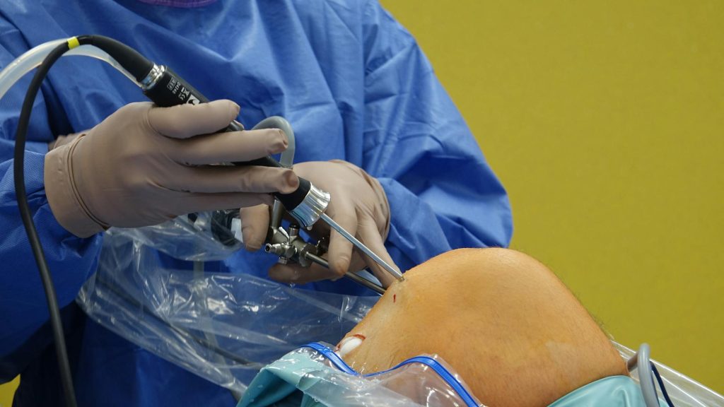 surgeon performing knee arthroscopy procedure